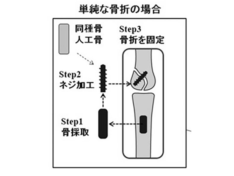 株式会社日進FULFIL05